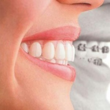Gloria Itzel Cervantes Pavon, Dentista - Odontólogo Cuajimalpa de Morelos