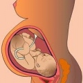 Aidee Eugenia Chacon Calderon