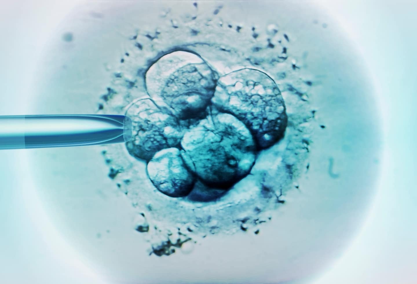 DNA editing of human embryos reignites debate over designer babies