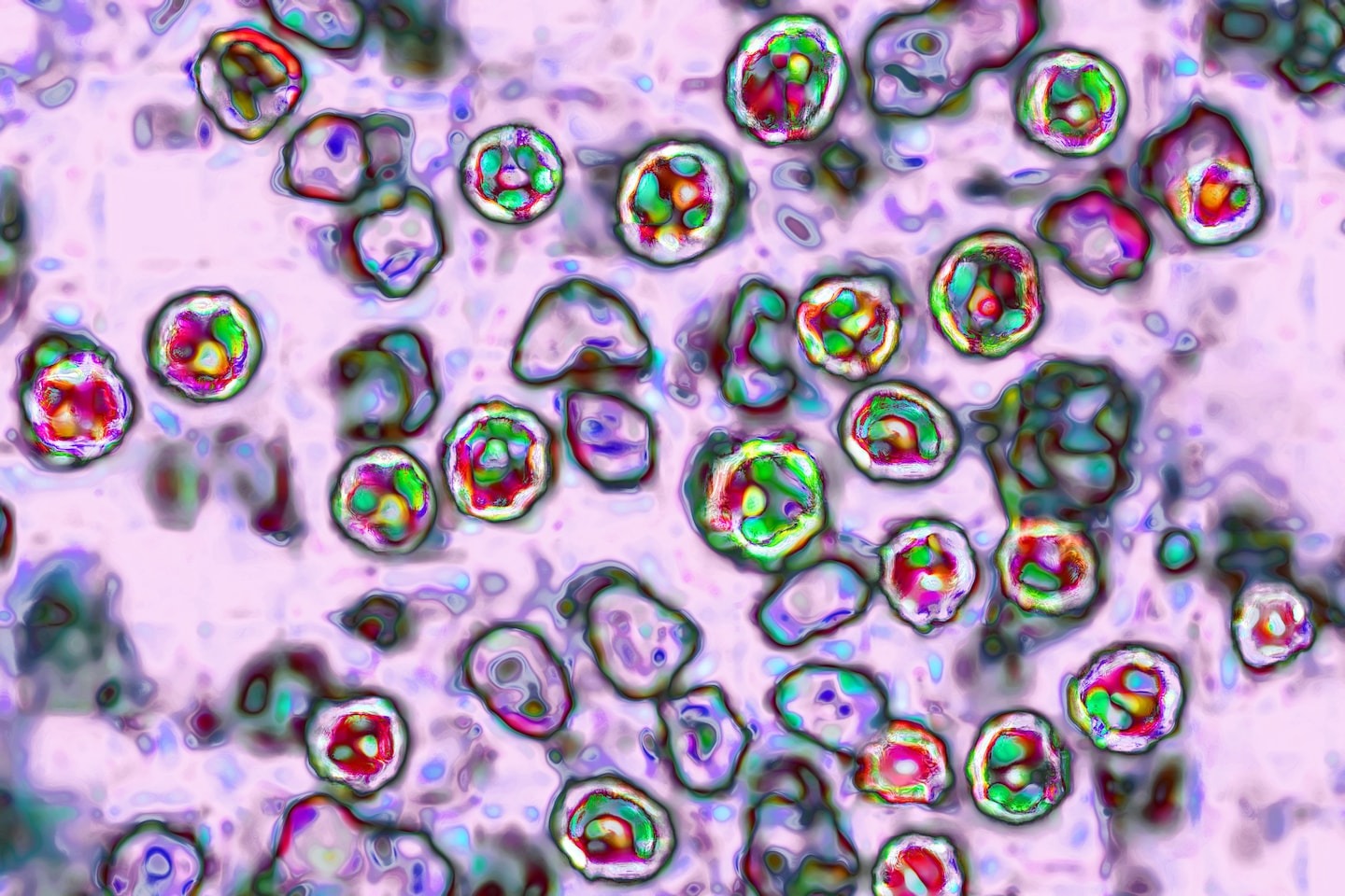 Column | Measles can erase up to 73 percent of your immune system’s memory