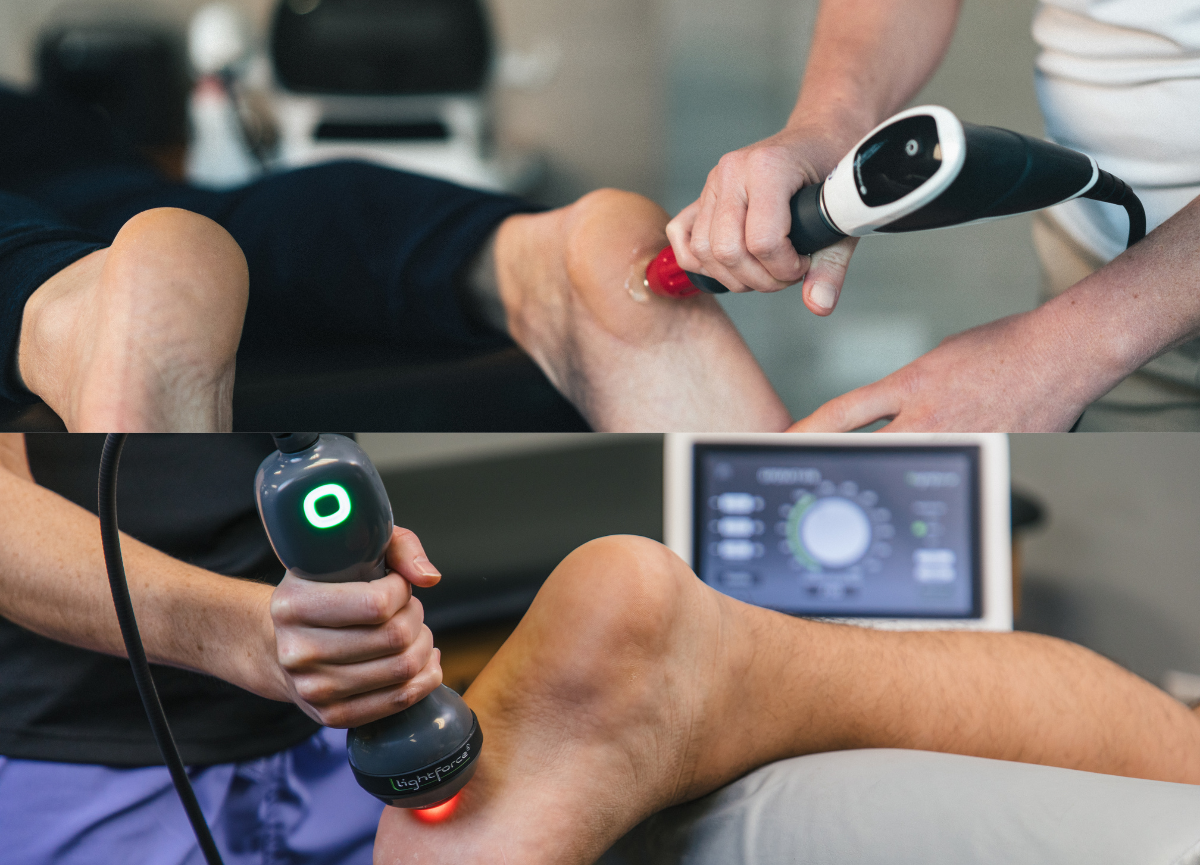 Aplicación de láser y ondas de choque en el pie para tratar fascitis plantar.