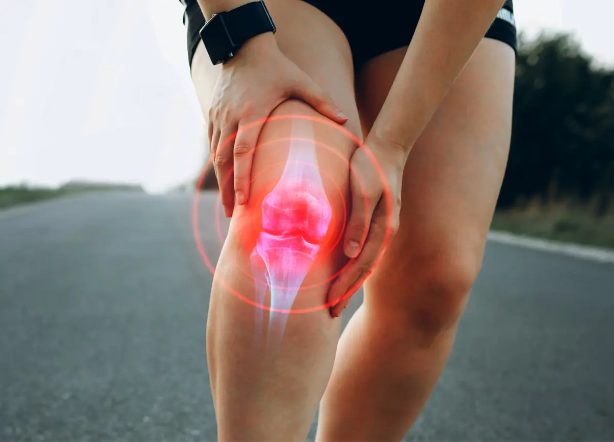 Osteoartritis de rodilla