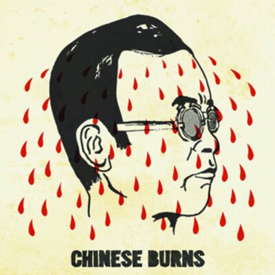 Chinese Burns - Calculator