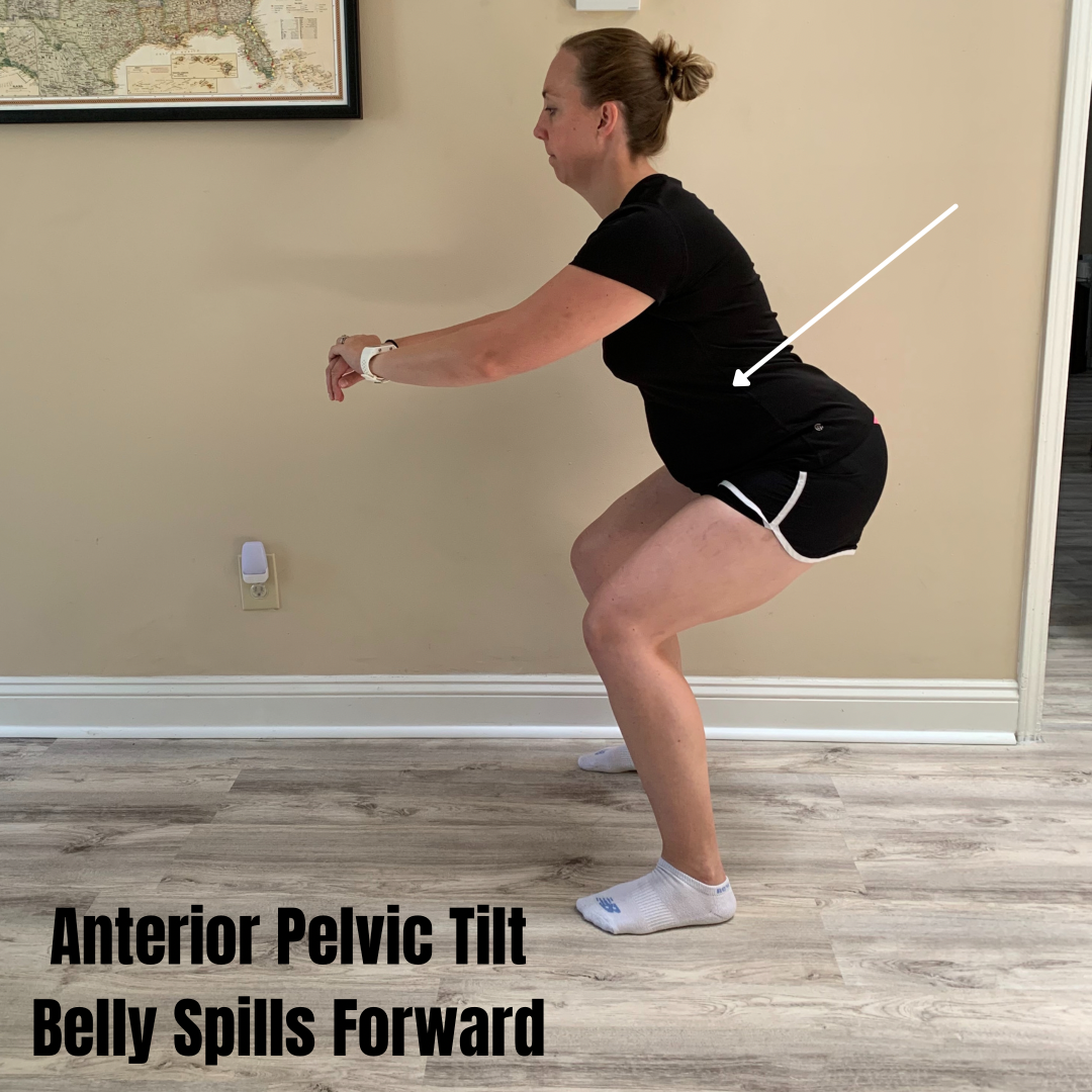 Female Squatting, showing how anterior pelvic tilt form can hurt the low back