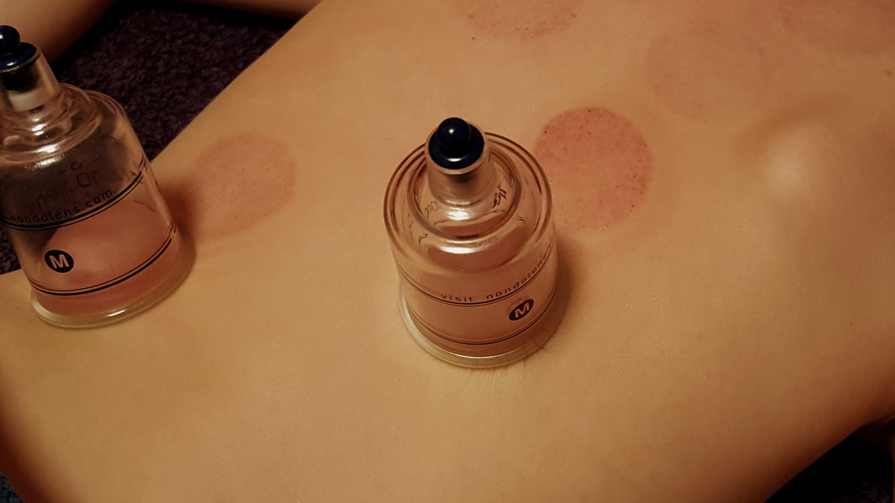 حجامة رياضية للرياضيين 