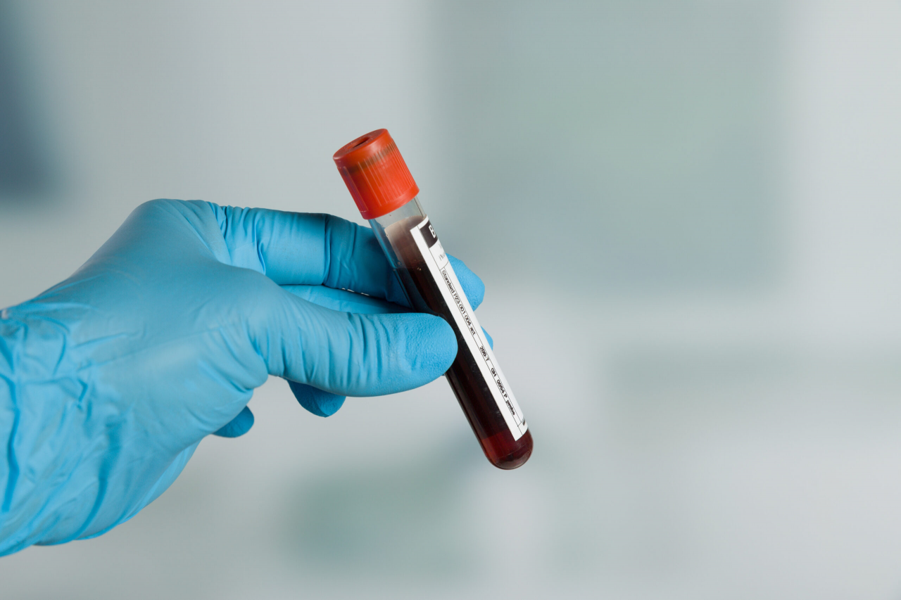 Blood test use to diagnose IBS