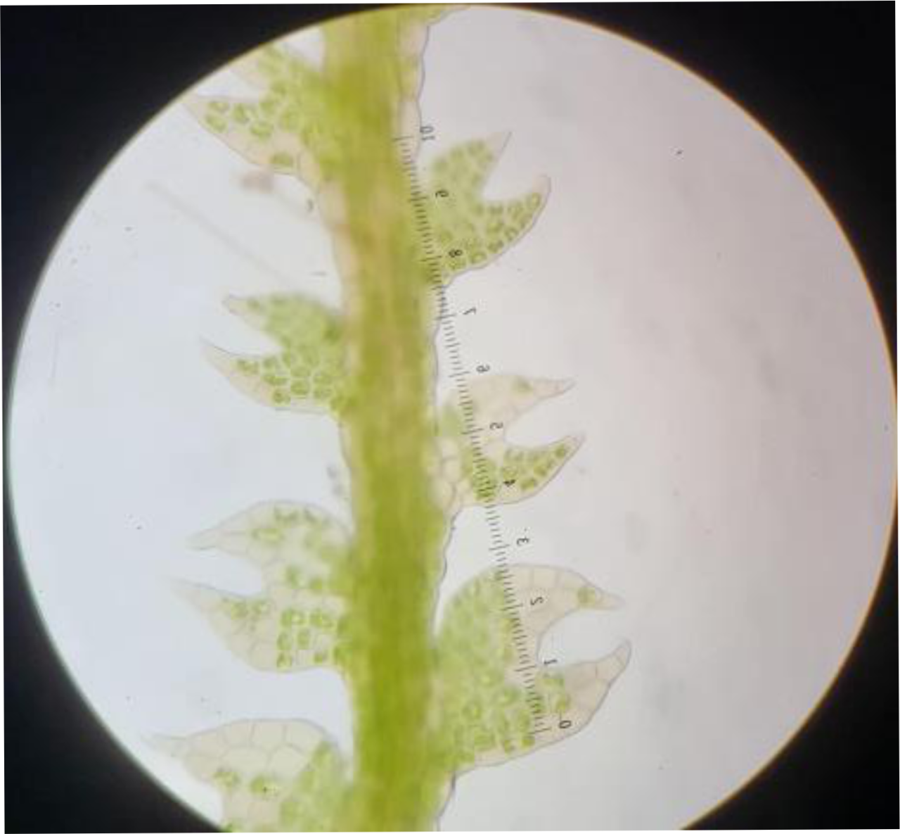 Microscope image of a leafy liverwortCephalozia sp. showing lobed, pincer-shaped leaves and internal cellular details, with a scale visible.