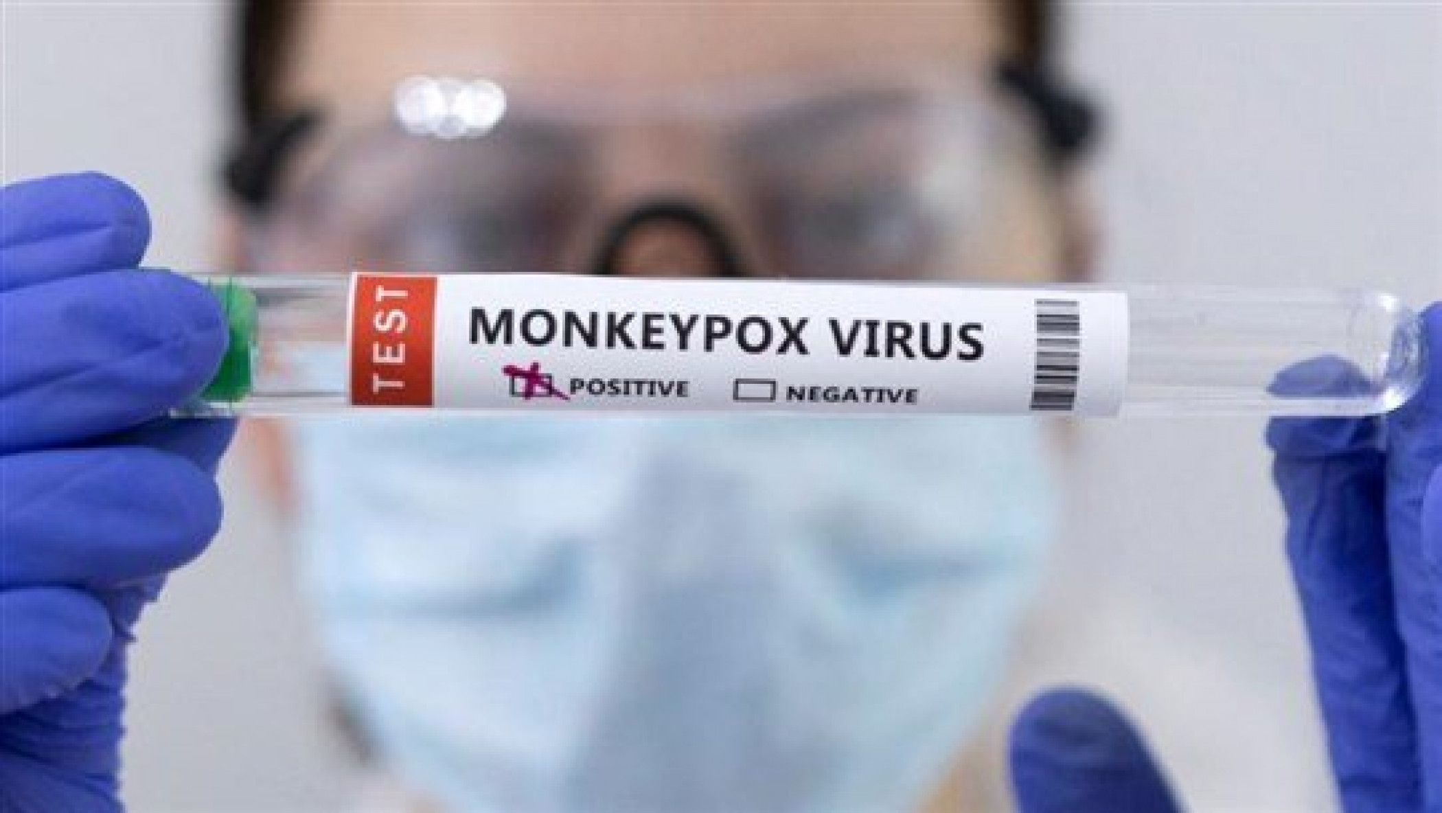 Monkeypox emergency could last months, with window closing to stop spread, experts say