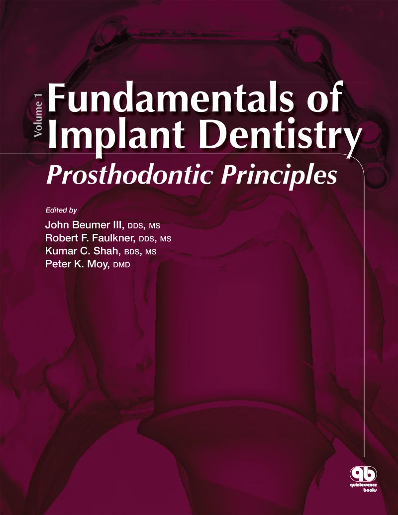 Portada: Fundamentals of Implant Dentistry, Volume 1