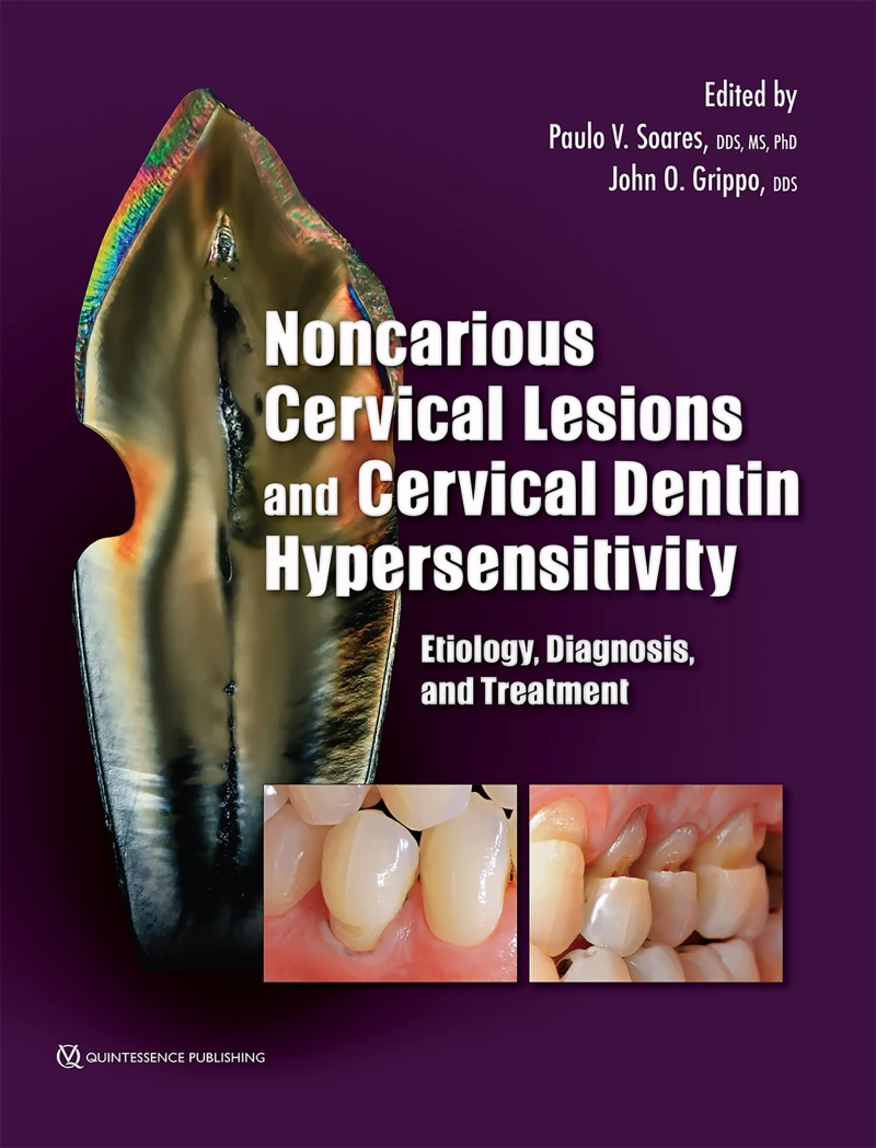 Portada: Noncarious Cervical Lesions and Cervical Dentin Hypersensitivity