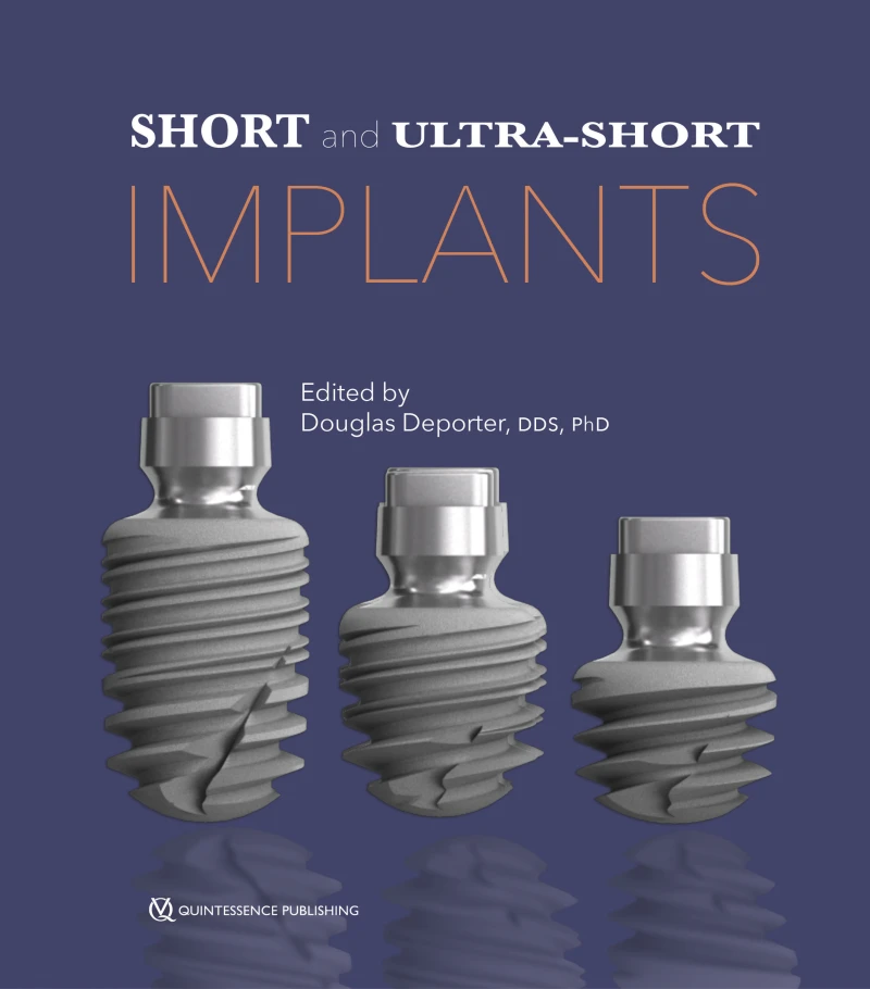 Portada: Short and Ultra-Short Implants