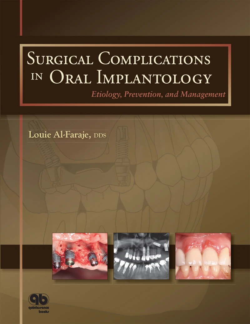 Portada: Surgical Complications in Oral Implantology