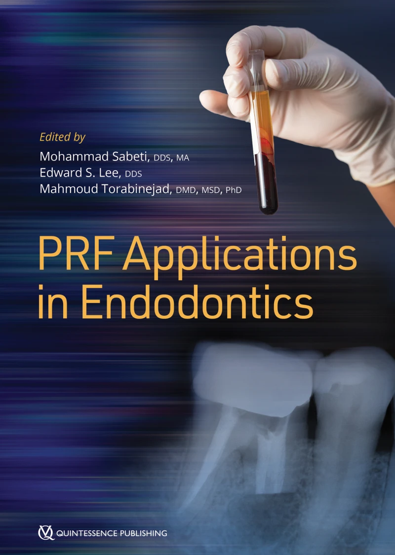 Portada: PRF Applications in Endodontics