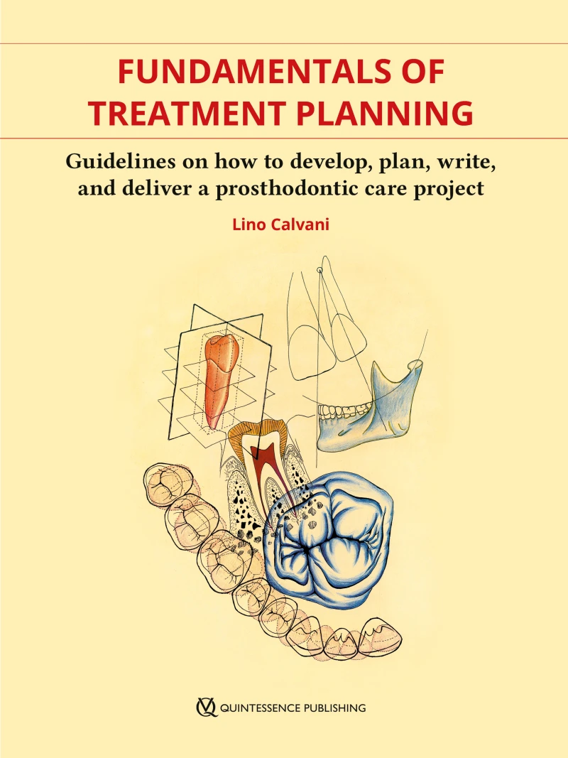 Portada: Fundamentals of Treatment Planning