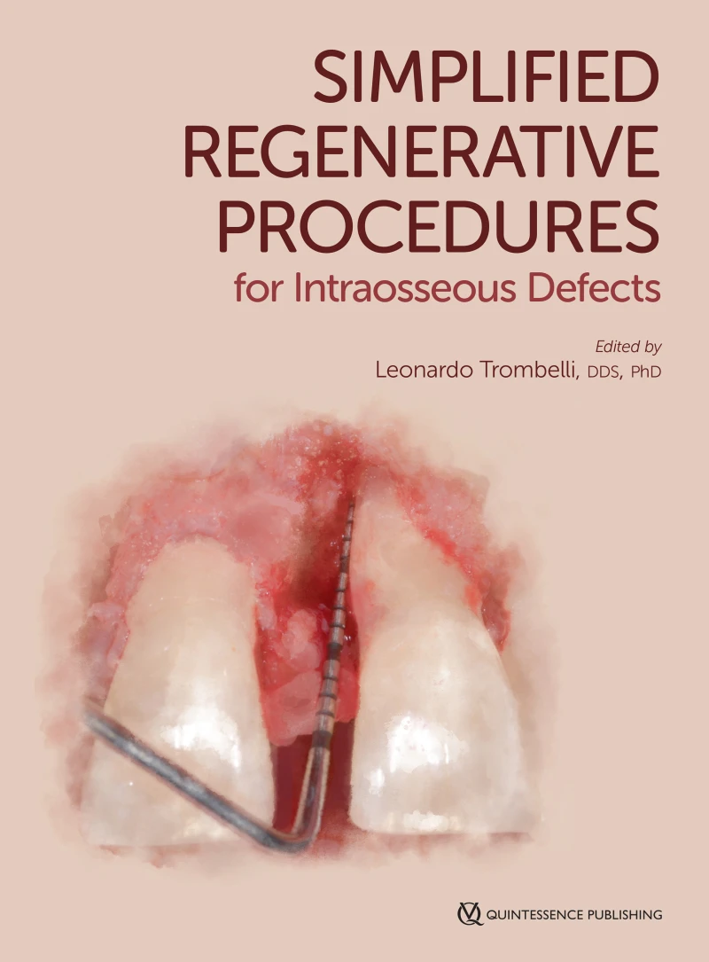 Portada: Simplified Regenerative Procedures for Intraosseous Defects