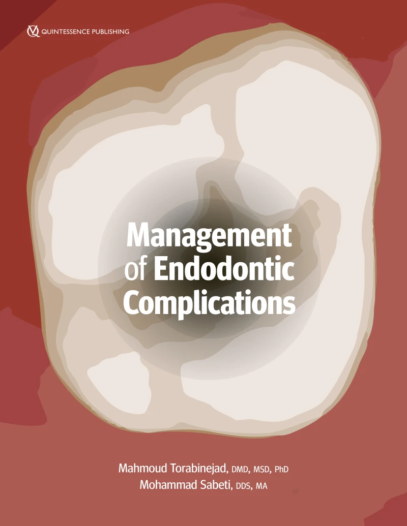 Portada: Management of Endodontic Complications