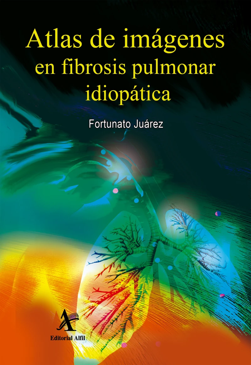 Portada: Atlas de imágenes en fibrosis pulmonar idiopática