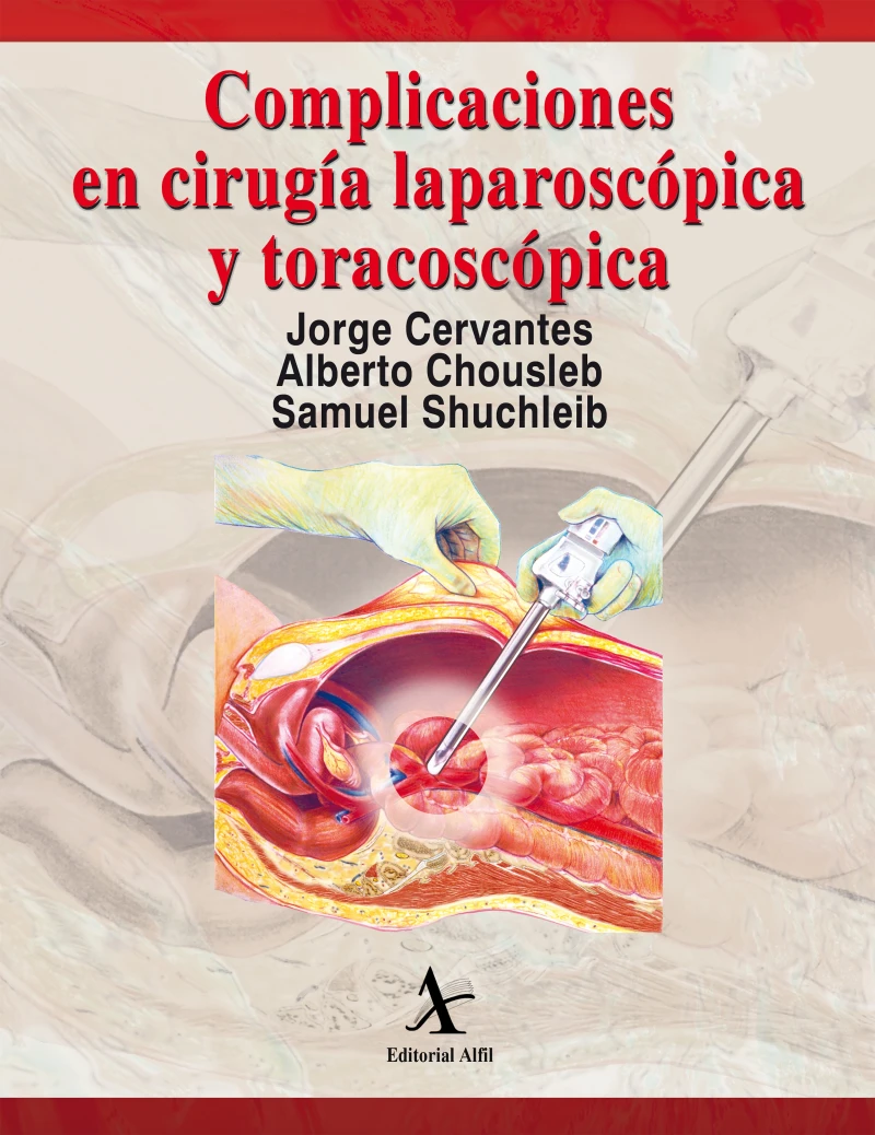 Portada: Complicaciones en cirugía laparoscópica y toracoscópica