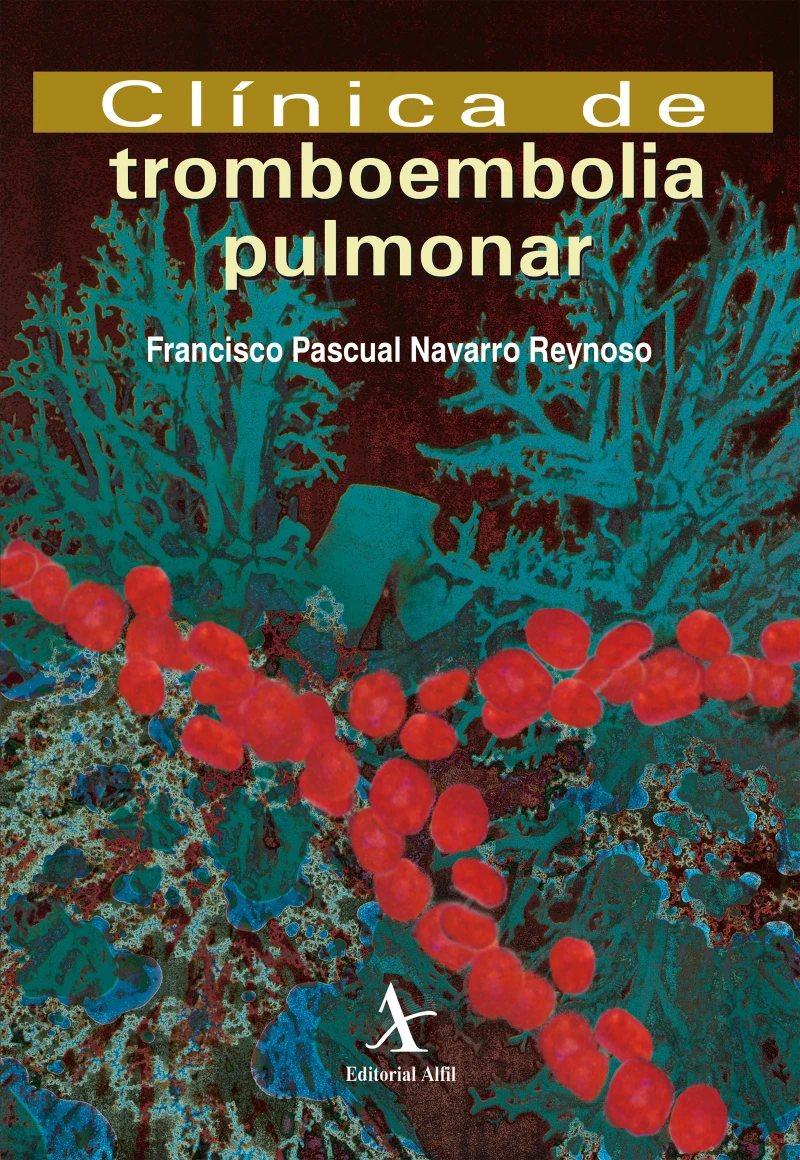 Portada: Clínica de tromboembolia pulmonar