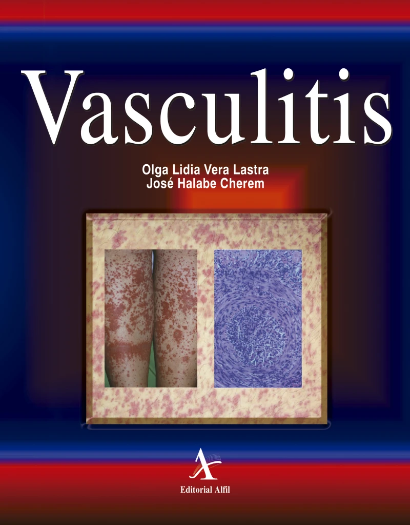 Portada: Vasculitis