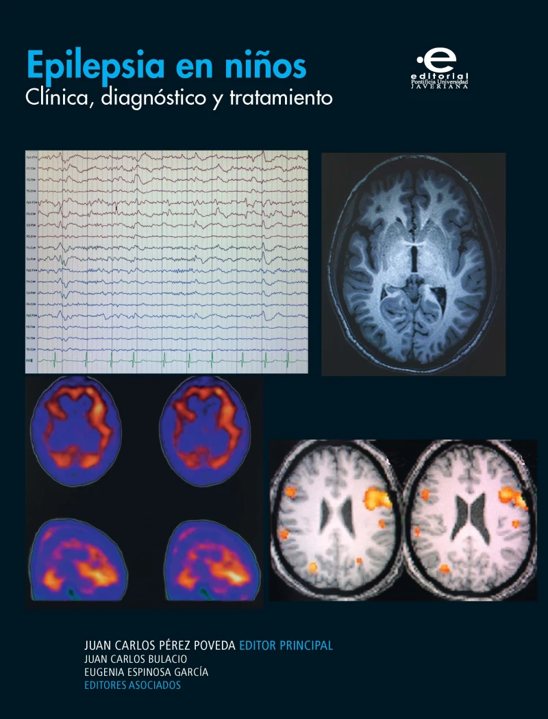 Portada: Epilepsia en niños