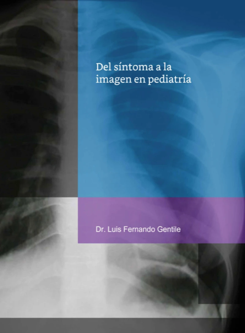 Portada: Del síntoma a la imagen en pediatría