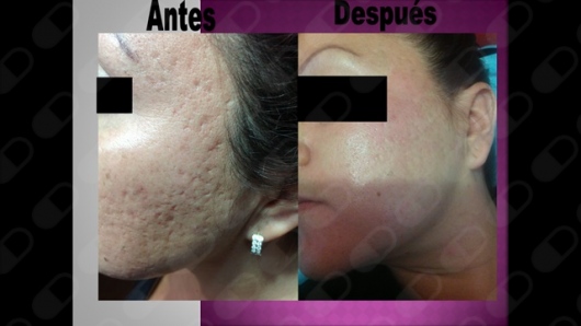 Mercedes Fernández Reyes-26