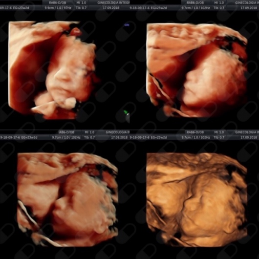 Oscar Alejandro Sánchez Gámez-23