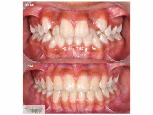 Alerí Morales Rodríguez-8