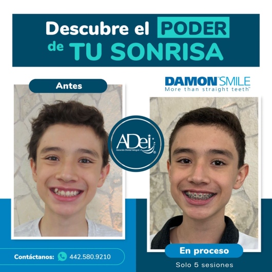 Víctor Amador-1