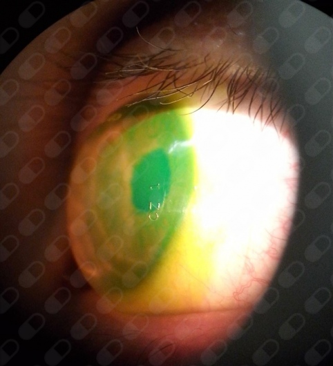 César Enoc Sandoval Pérez-7