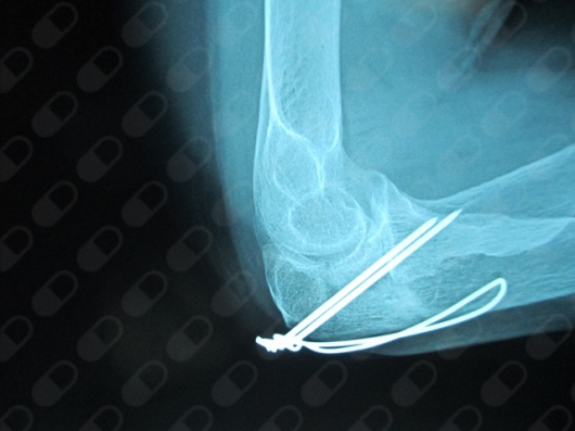 José Angel Salazar Granados-3