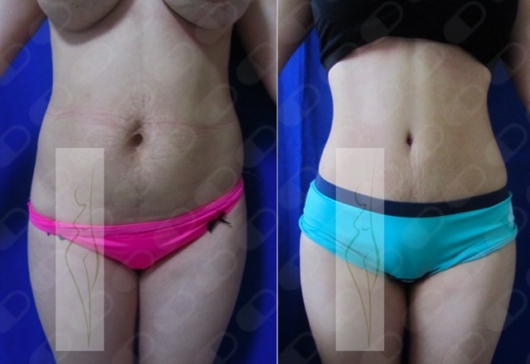 Rubén Nieto Balcázar-19