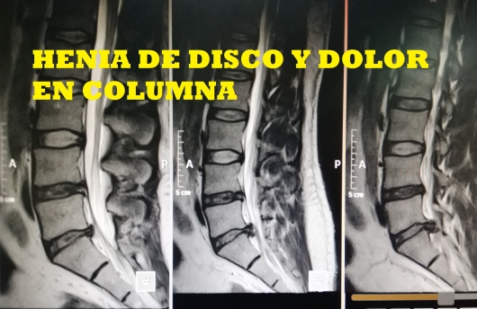 Gerardo Segundo Primero-12