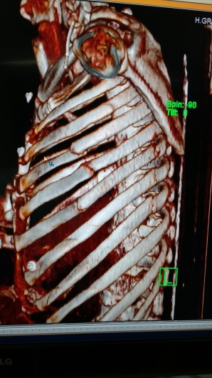 Gustavo Alvarez Bestoff-6