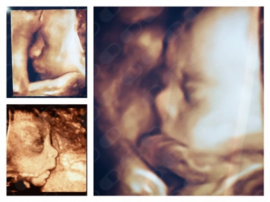 Fabiola Elizabeth Garcia Padilla-26