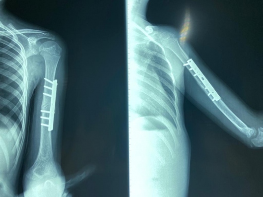 Valerio Licerio De La Cruz-10