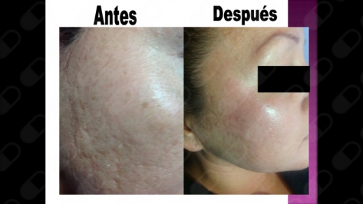 Mercedes Fernández Reyes-24