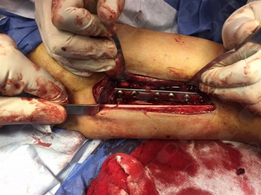 Óscar García Prieto-3