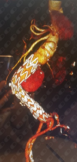 Gerardo Lozano Balderas-5