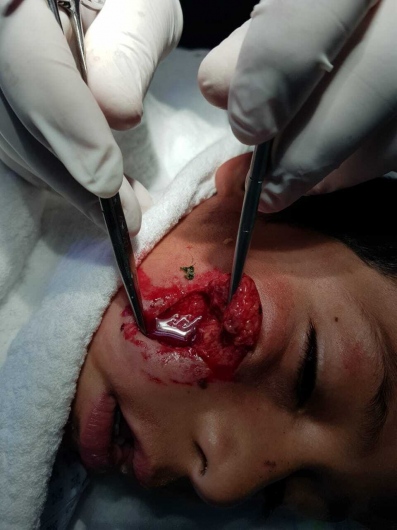 Valerio Licerio De La Cruz-20