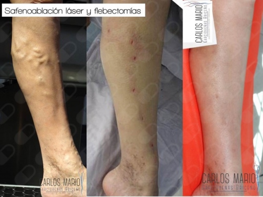 Carlos Mario Garcidueñas Briceño-9