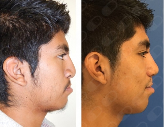 José Antonio García Piña-9