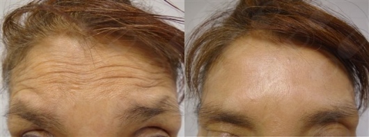 Ismael Cheng Flores-6