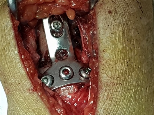 Óscar García Prieto-5