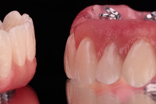 Dilan González Castrejon-16