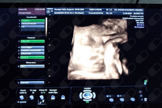 Andrés R. Herrera González-3