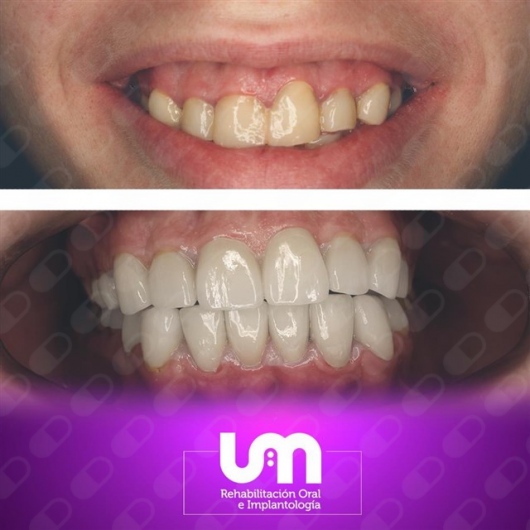 Alejandro Uribe Marioni-9