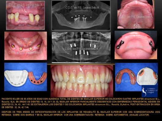 Leonel Brito Armas-3