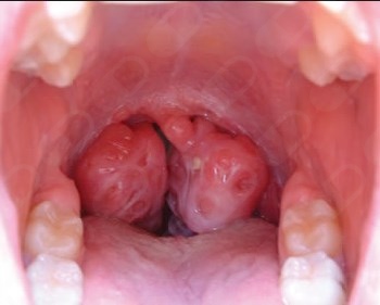 Martha Elena Crispín López-4